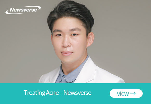 Treating Acne – Newsverse